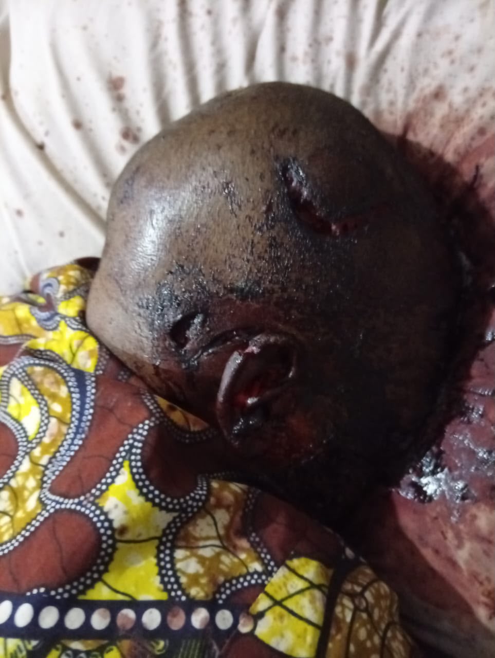 FCT Police Arraign Three over Alleged Murder of Man in Guzape
‎