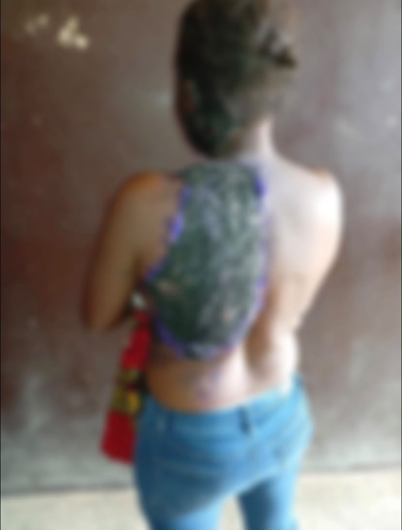 Woman Remanded After Allegedly Pouring Boiling Water on Neighbour in Abuja